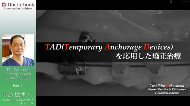 TAD(Temporary Anchorage Devices)を応用した矯正治療 | Doctorbook