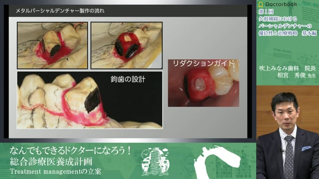 なんでもできるドクターになろう！ 総合診療医養成計画①　欠損補綴におけるパーシャルデンチャーの優位性と治療戦略　基本編