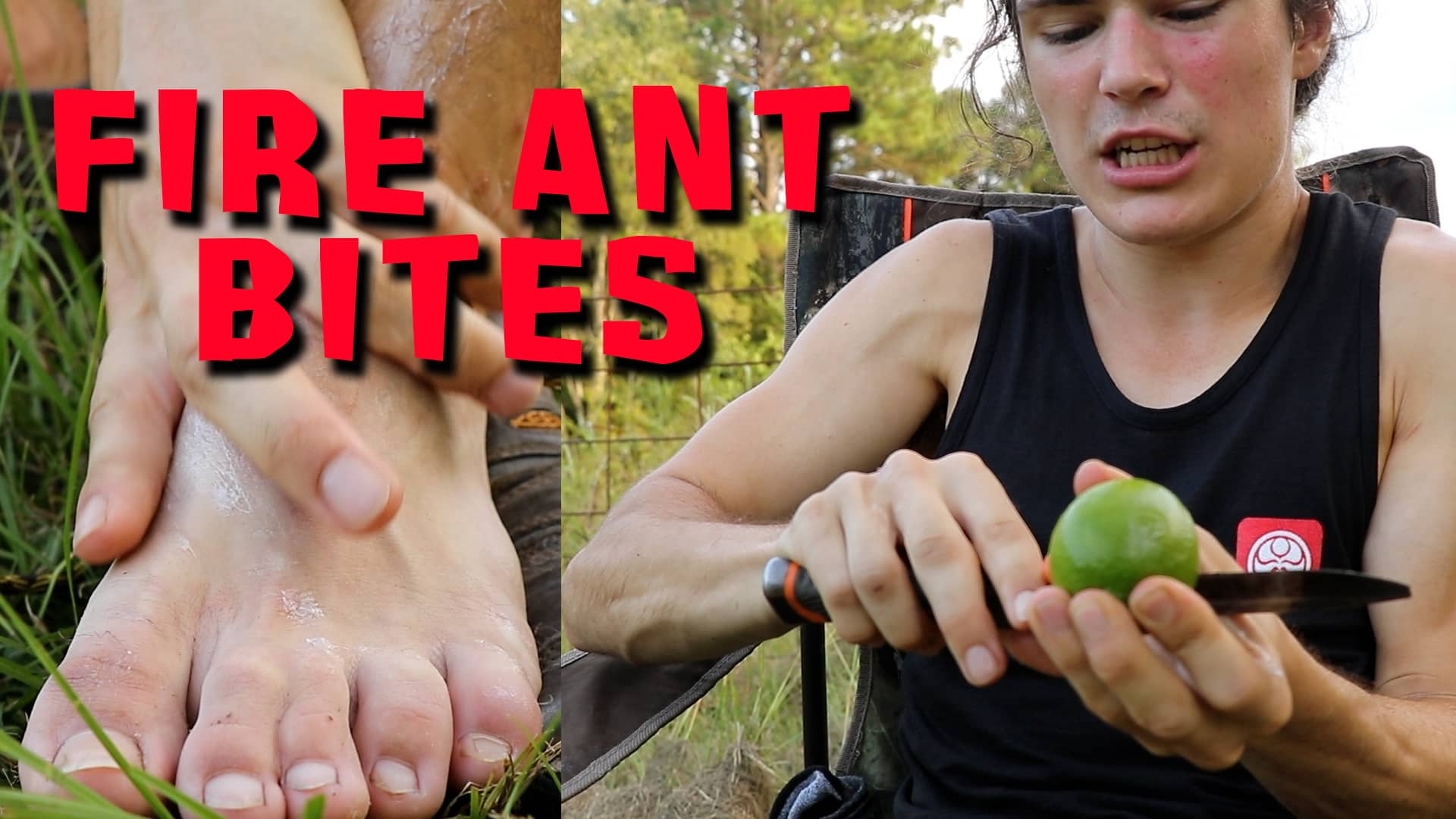 wildsides-how-to-treat-fire-ant-bites-on-vimeo