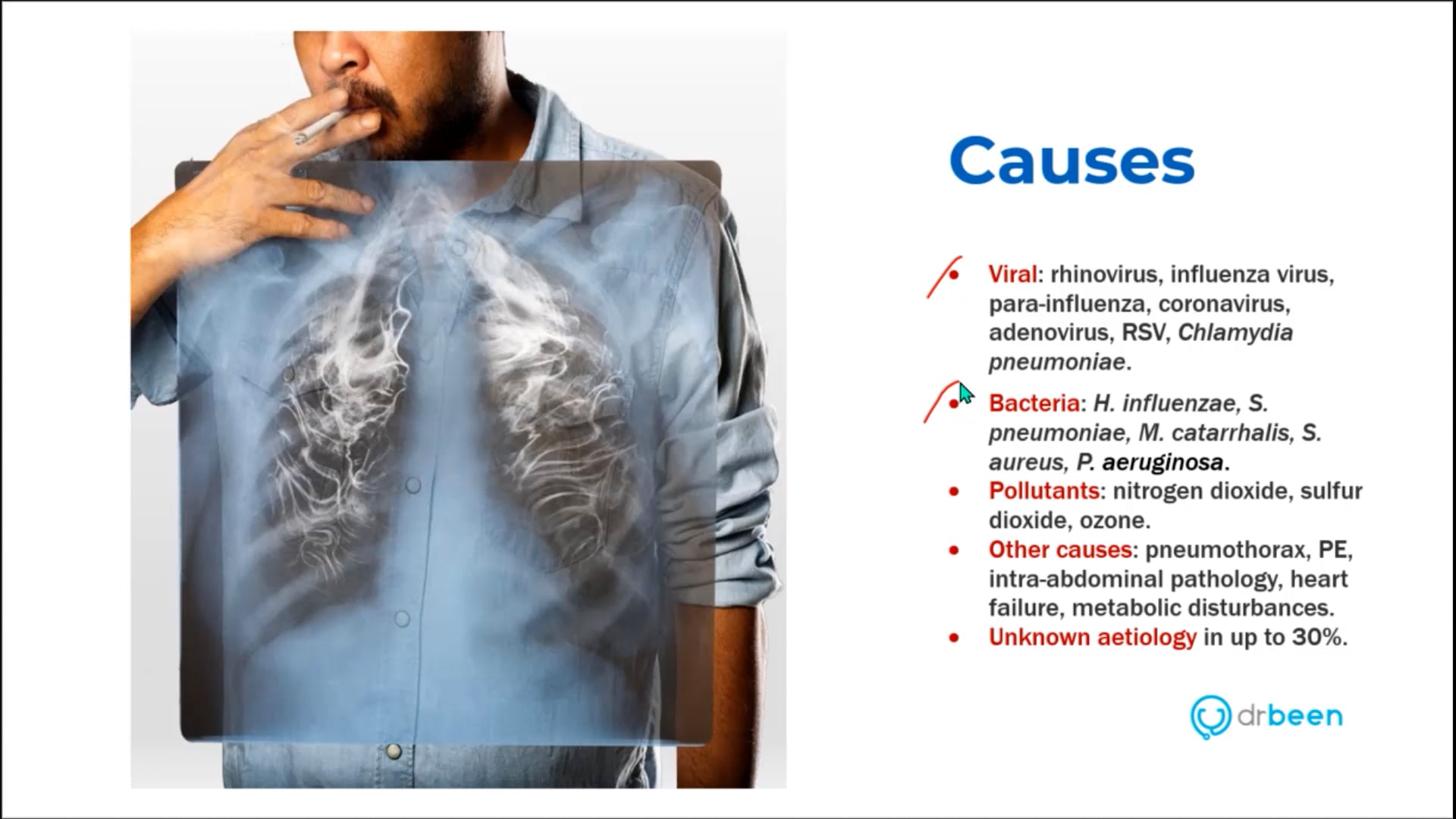 COPD Exacerbation