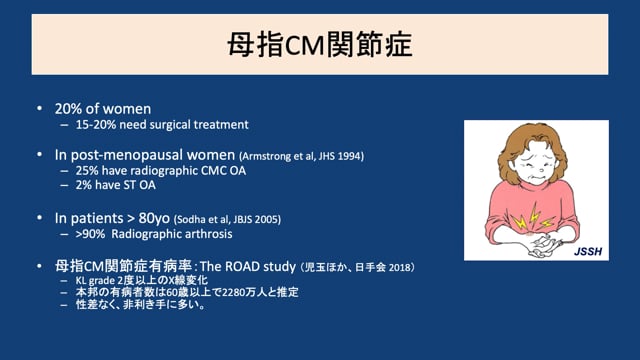 母指CM関節症の症状・診断・治療