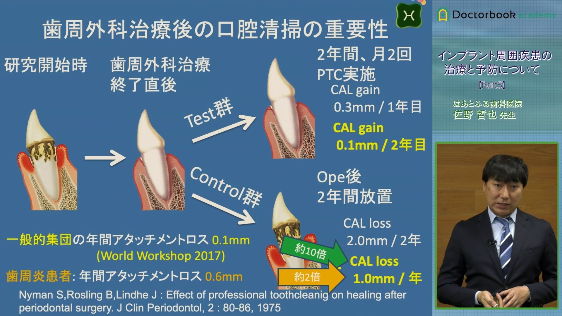 #5 インプラント体表面の形状と粗さについて