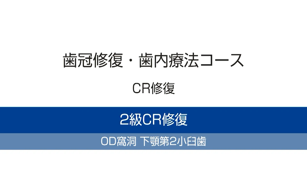 GP臨床トレーニング BOOK & MOVIE（2）歯冠修復 編| 歯科総合