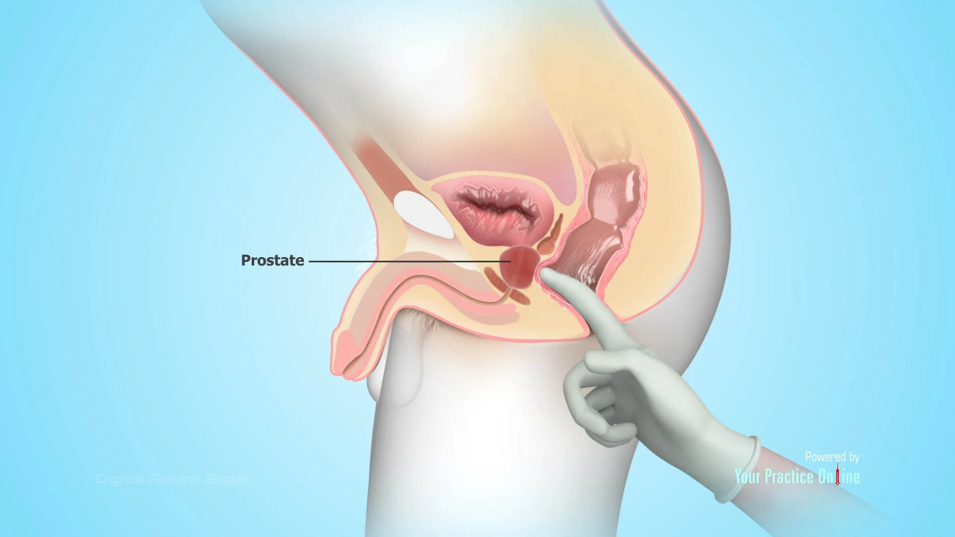 pediatric exam genital 