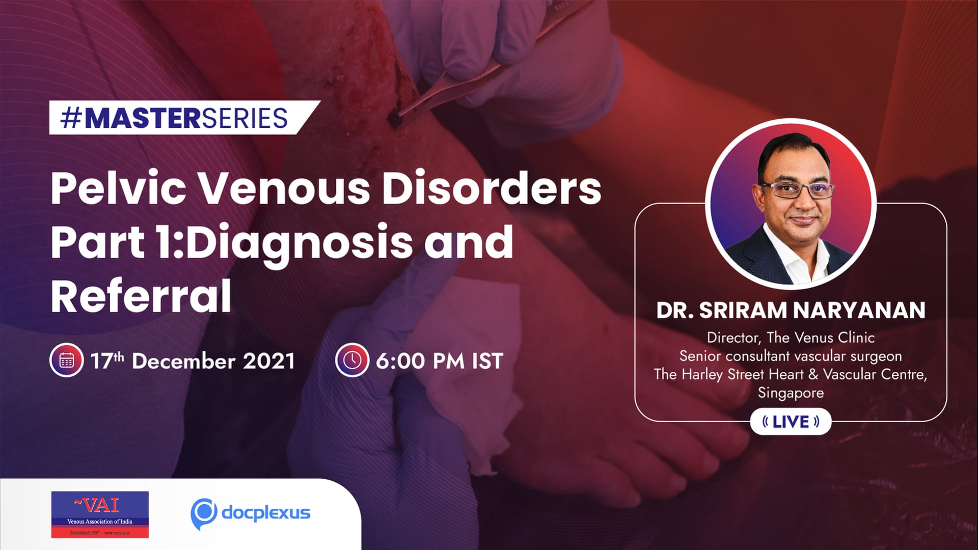 Pelvic Venous Disorders Part 1:Diagnosis and Referral