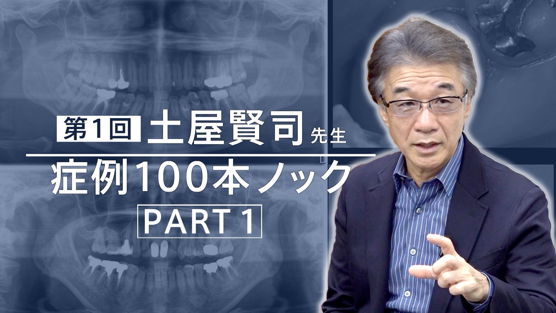 土屋賢司先生 症例100本ノック 第1回 PART1