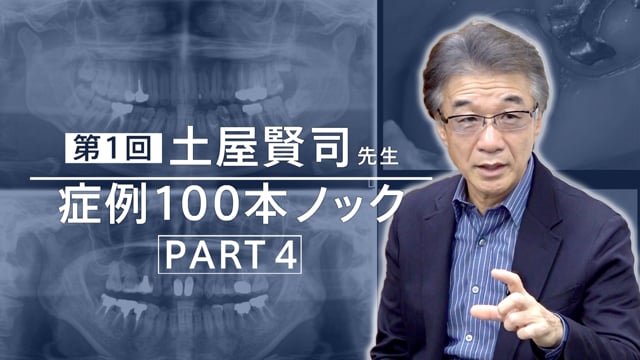 土屋賢司先生 症例100本ノック 第1回 PART4