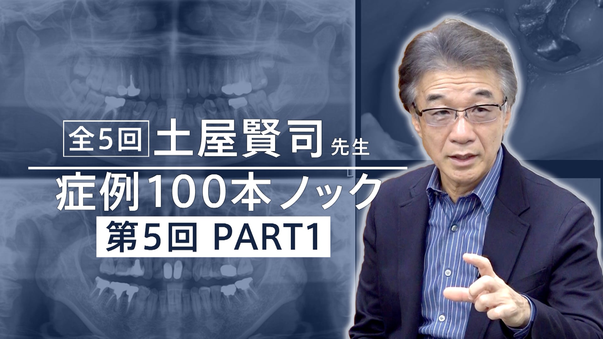 土屋賢司先生 症例100本ノック 第5回 PART1