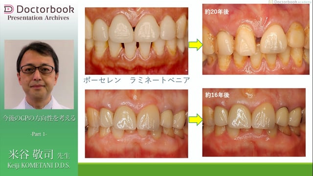 今後のGPの方向性を考える