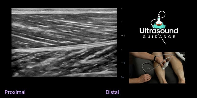 Muscle Scan