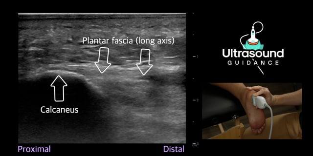 Plantar Foot Scans