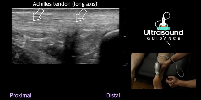 Posterior Ankle Scans