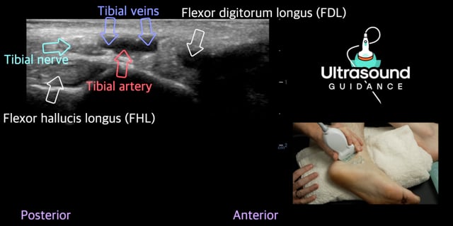 Medial Ankle Scans