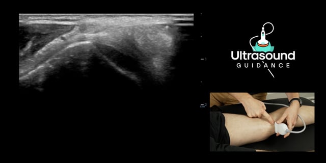 Posterior Knee Scans