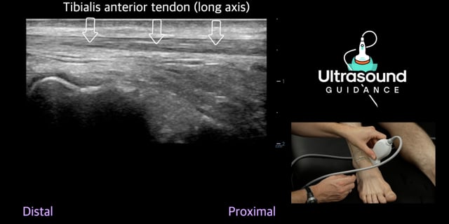 Anterior Ankle Scans