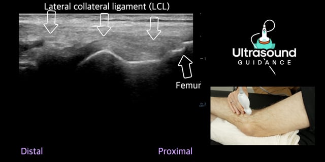 Lateral Knee Scans