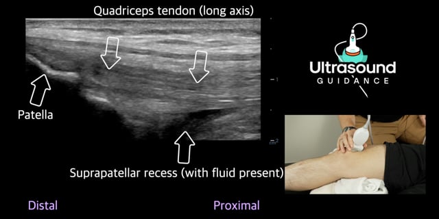 Anterior Knee Scans