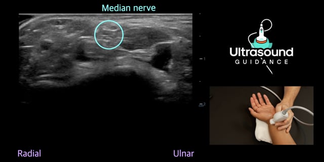 Volar Wrist Scans