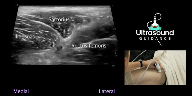 Anterior Hip Scans