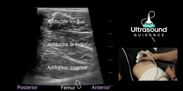 Medial Hip Scans