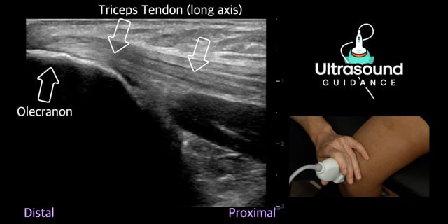 Posterior Elbow Scans