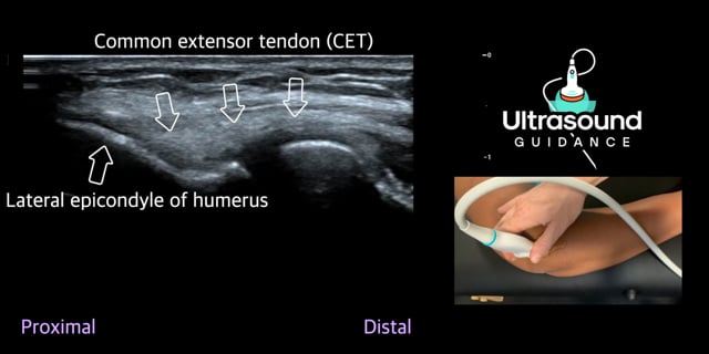 Lateral Elbow Scans