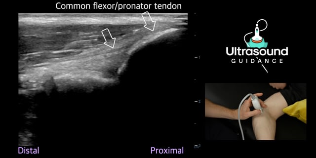 Medial Elbow Scans