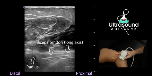 Anterior Elbow Scans