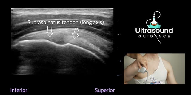 Shoulder Scans