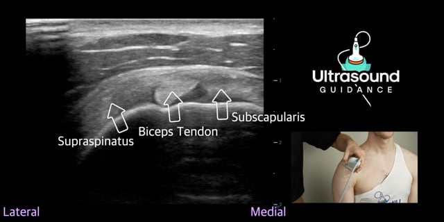 Ultrasound Basics