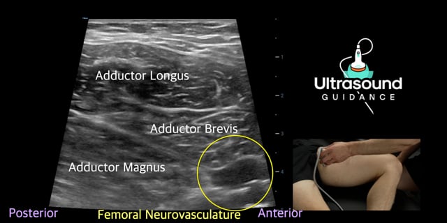 Lower Extremity Spasticity Scan