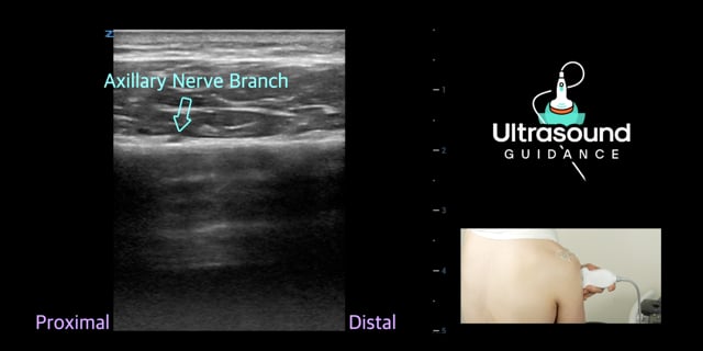 Axillary Nerve Scan