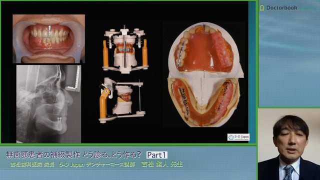 無歯顎患者の補綴製作 〜どう診る、どう作る？〜 | Doctorbook academy