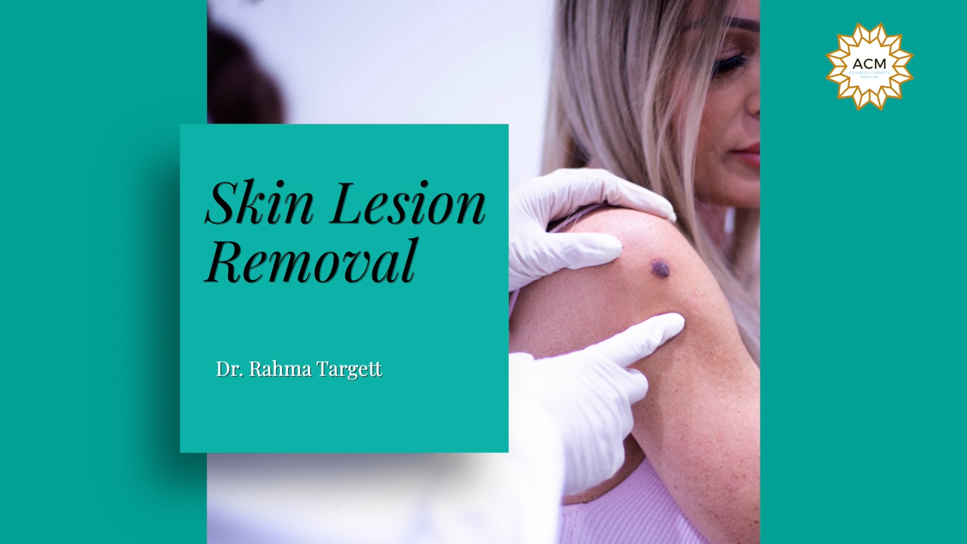 skin-lesion-removal-at-advanced-cosmetic-medicine-adelaide-on-vimeo