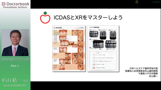 新しいう蝕治療をマスターしよう！「ICDASとXRをマスターしよう」
