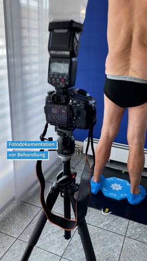 Coolsculpting - Fotodokumentation vor der Behandlung