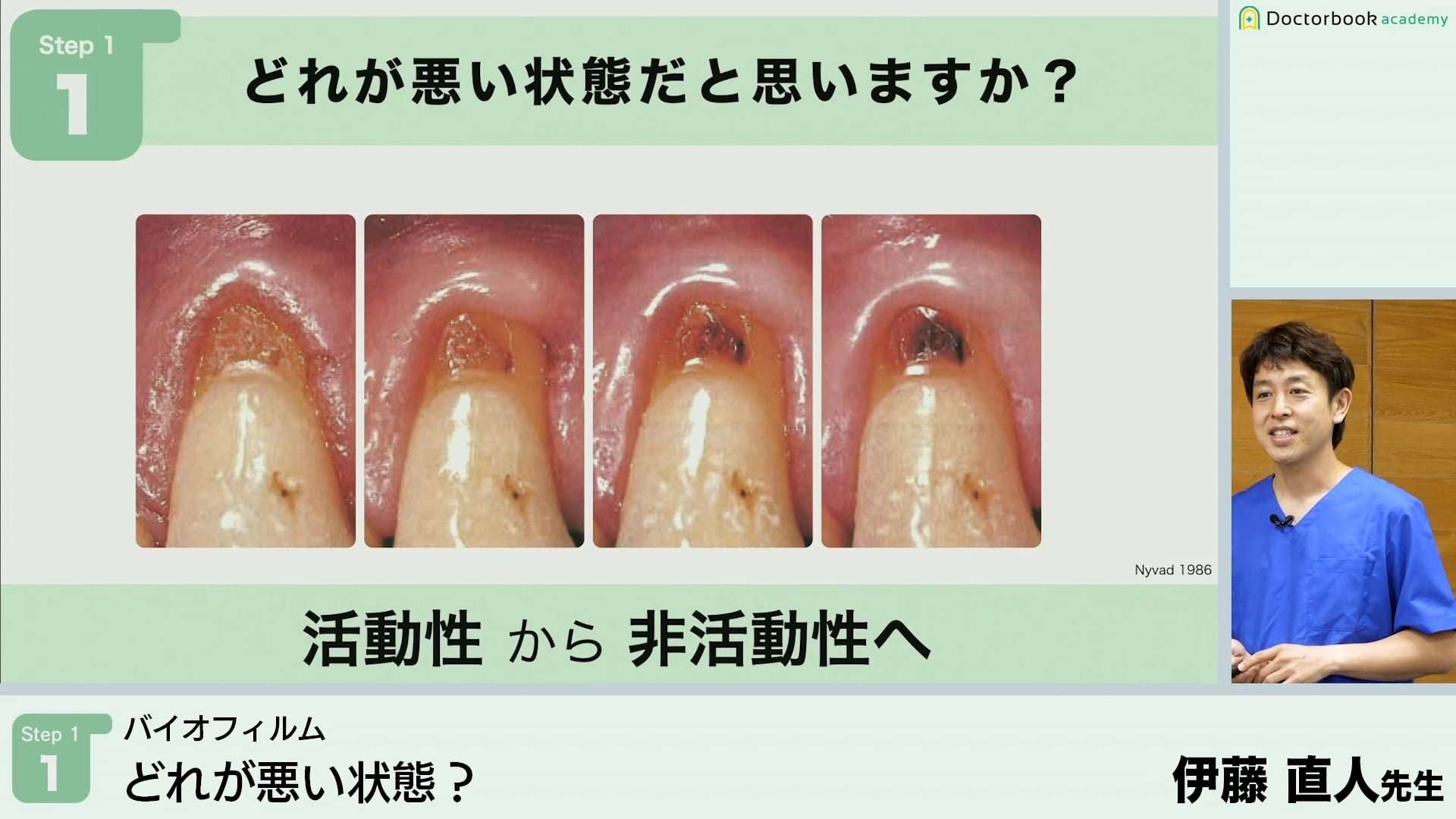 どれが悪い状態？│Step1-1