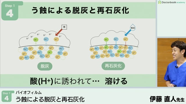 う蝕による脱灰と再石灰化│Step1-4【10/10-10/16 みんプレ会員無料視聴】