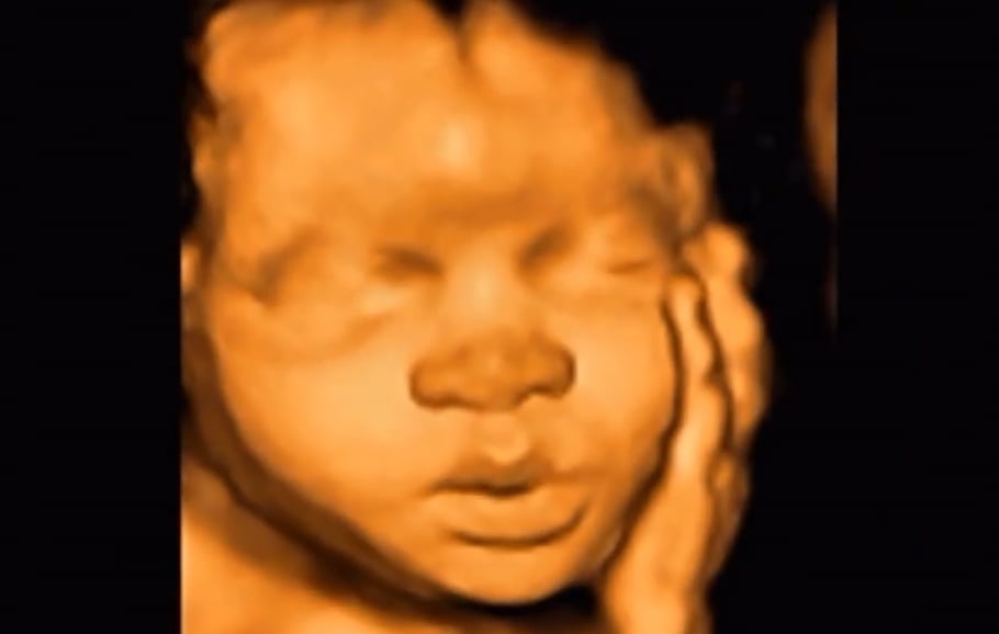 Mini Me Baby Scans Baby Scan, 3d Baby Scan, Ultrasound