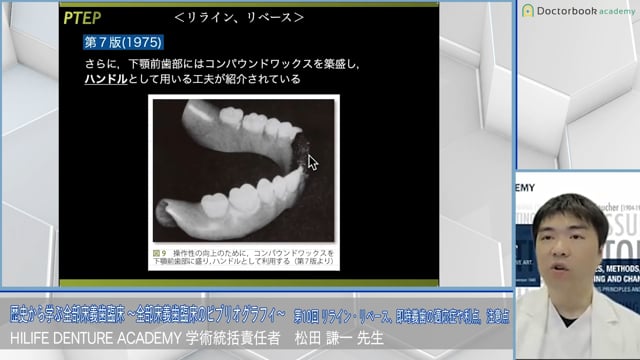 リライン・リベース、即時義歯の適応症や利点，注意点│歴史から学ぶ全部床義歯臨床 〜全部床義歯臨床のビブリオグラフィ〜 第10回