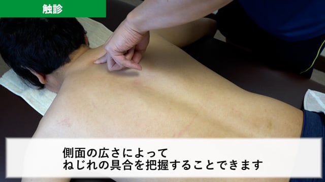 治療実例「脊椎のねじれ改善（メディチャーライト）」