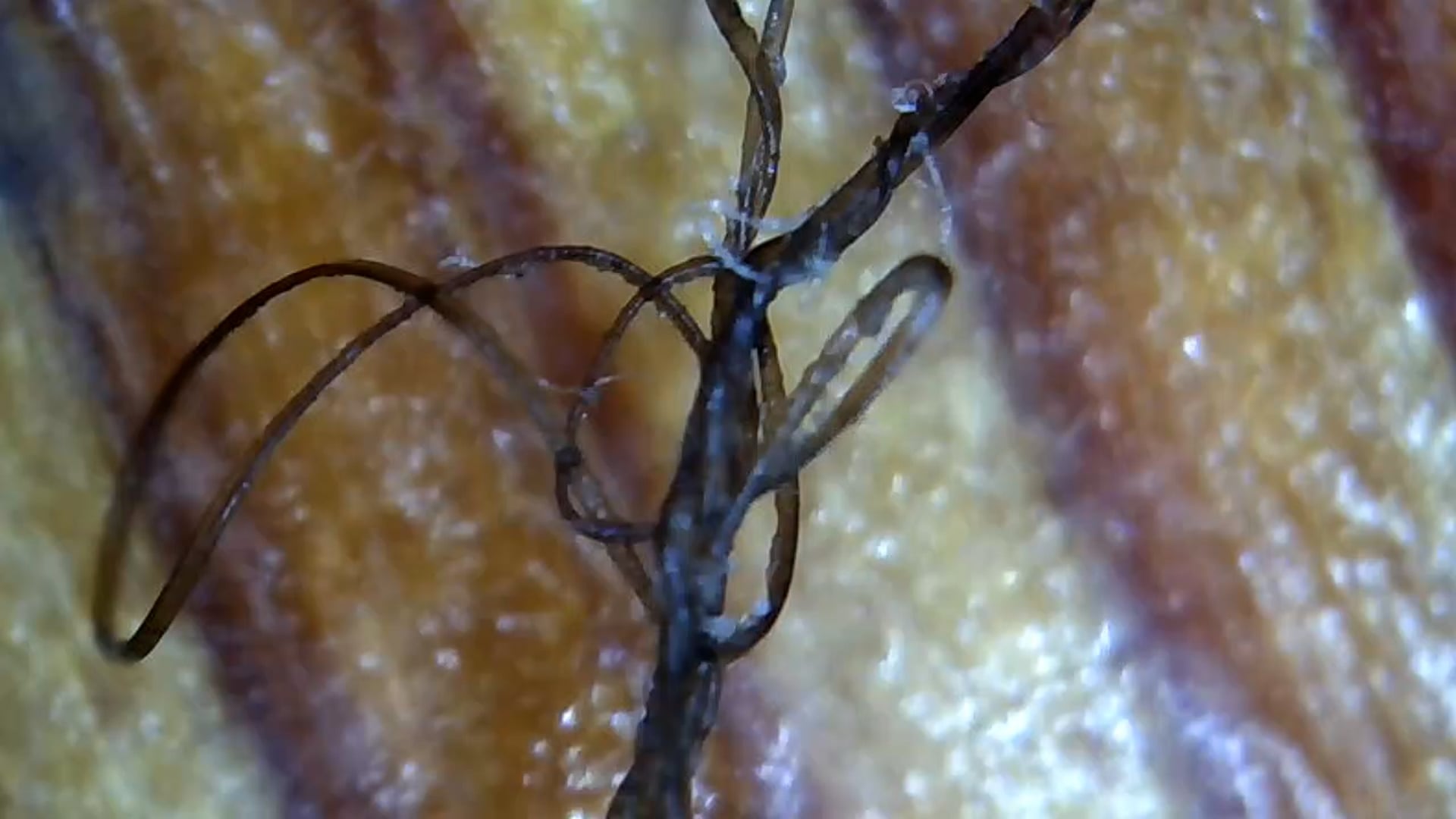 Thigh to Hip Banding Fullerene