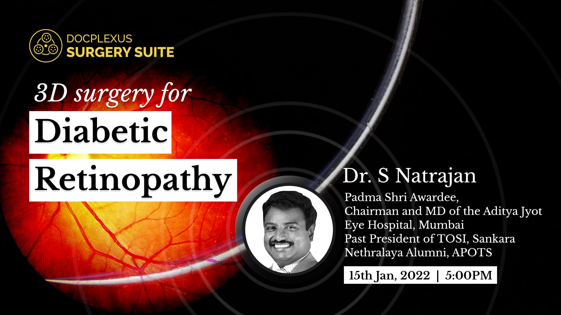 3D surgery for diabetic retinopathy