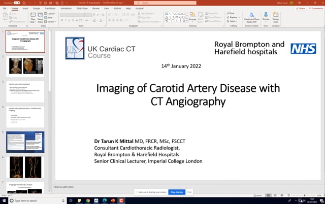 Carotid artery disease CTA UKCT Webinar – UK Cardiac CT Course