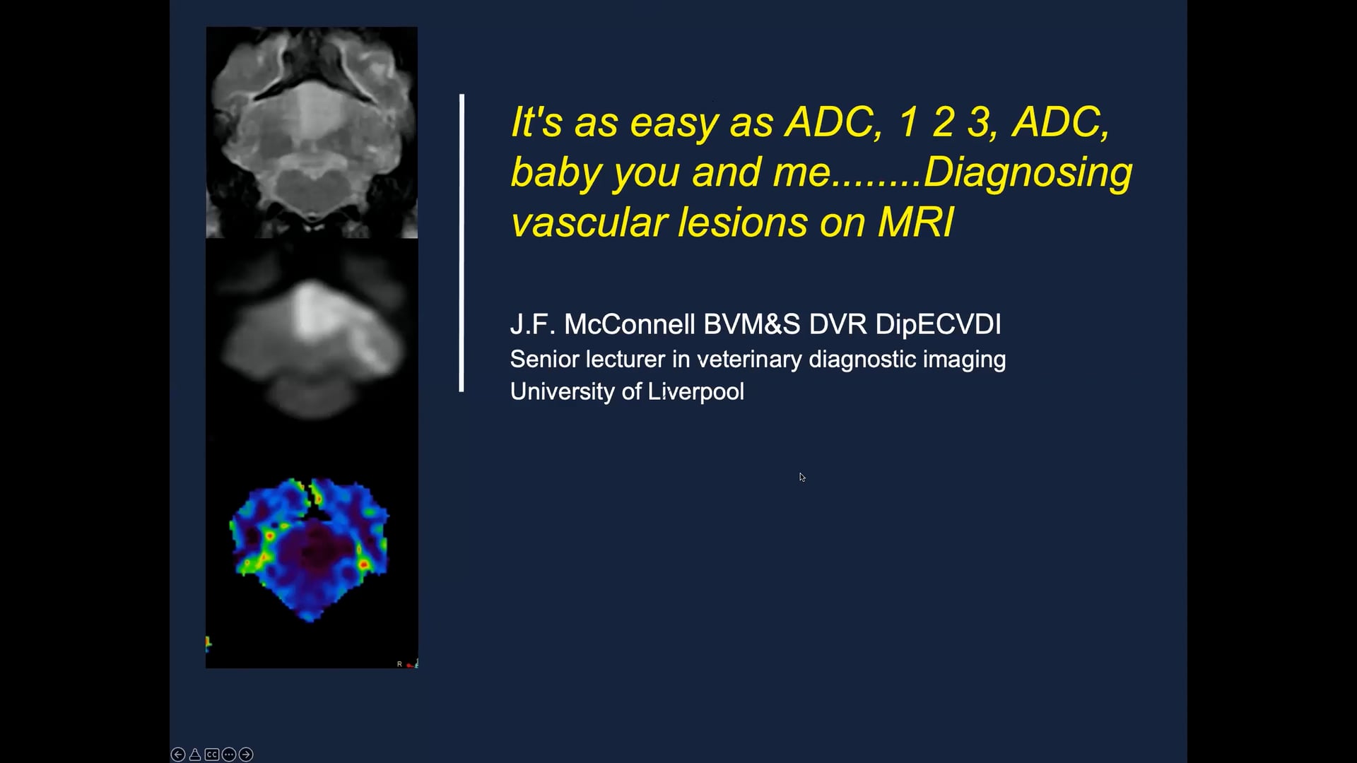 It's as easy as ADC, 1 2 3, ADC,  baby you and me........Diagnosing vascular lesions on MRI