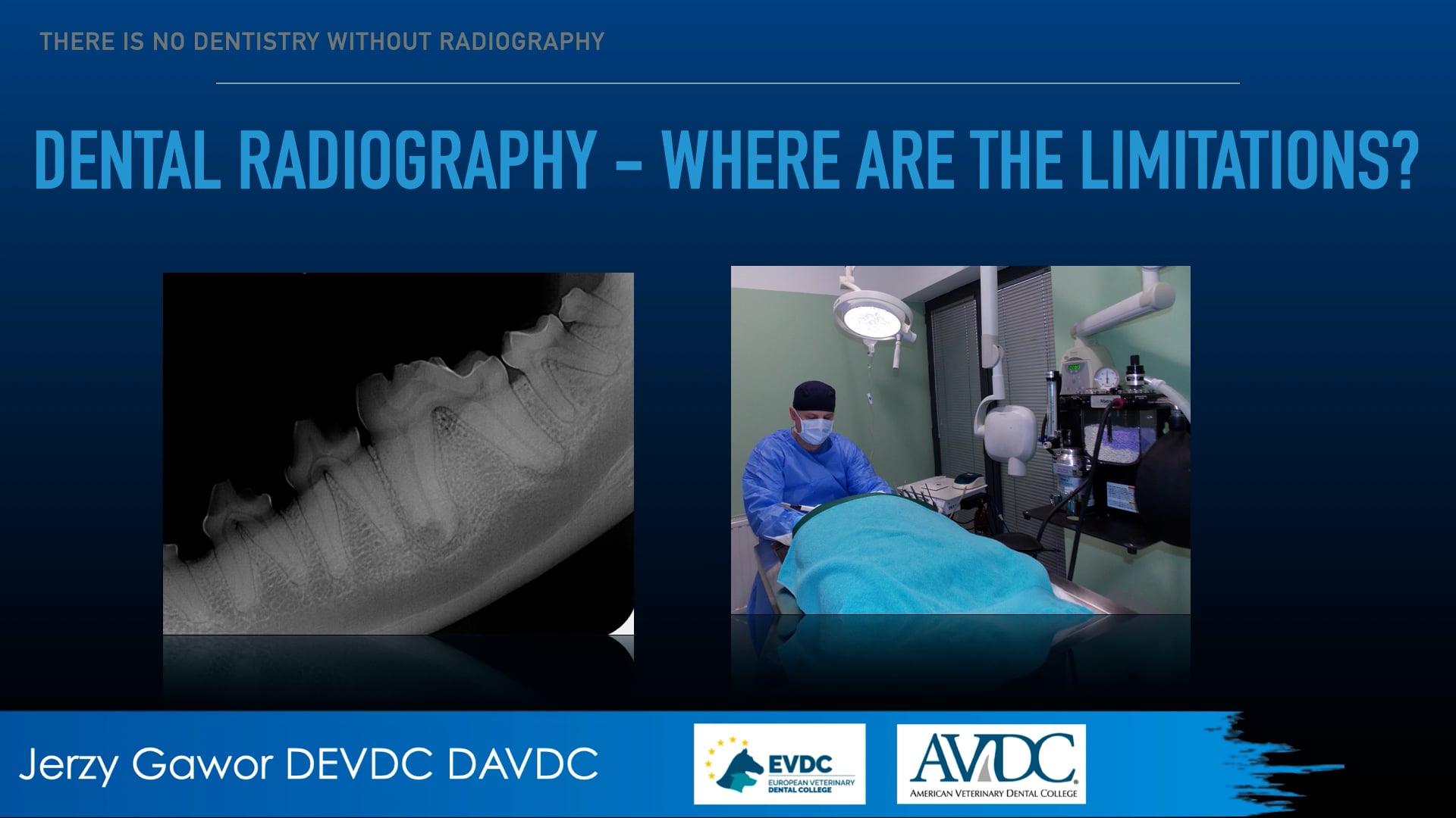 Dental radiography - where are the limitations?