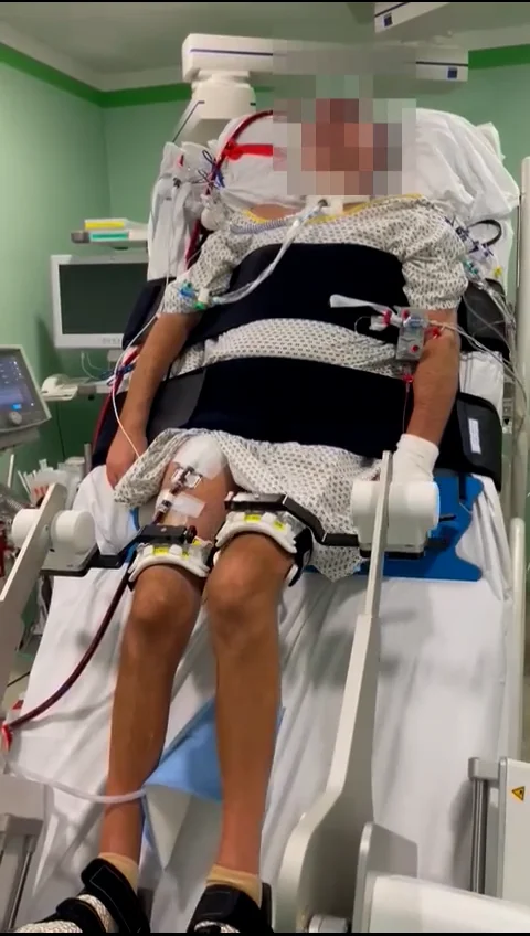 Robotic mobilization therapy of an Covid-ECMO patient using the ...