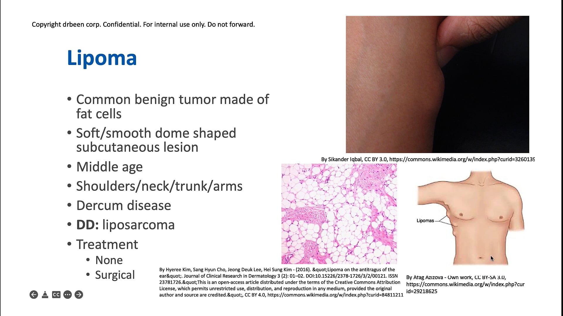 Benign Skin Lesions