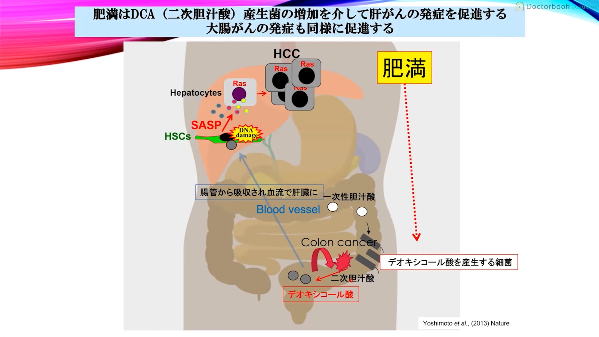 #2 口腔常在菌と大腸がんの研究