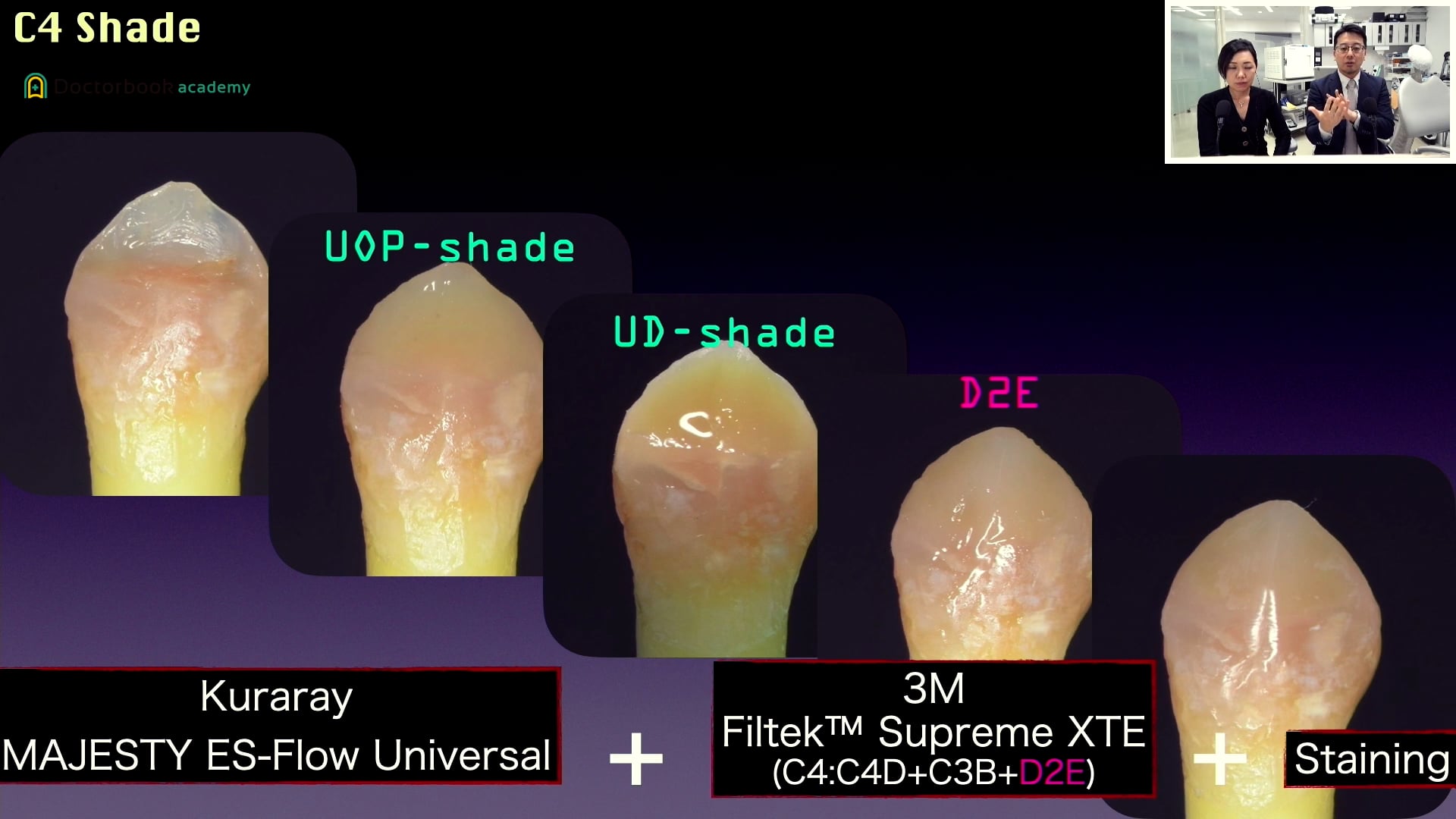 クリアフィル® マジェスティ® ES フロー Universalを用いた症例と実験 #5